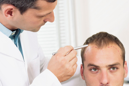 reasons for hair loss in men