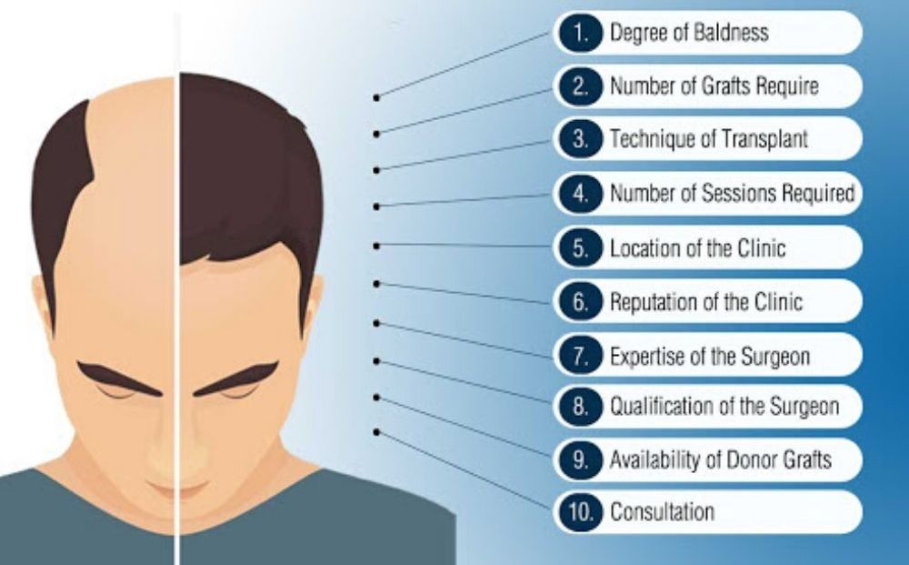 cost of hair transplant