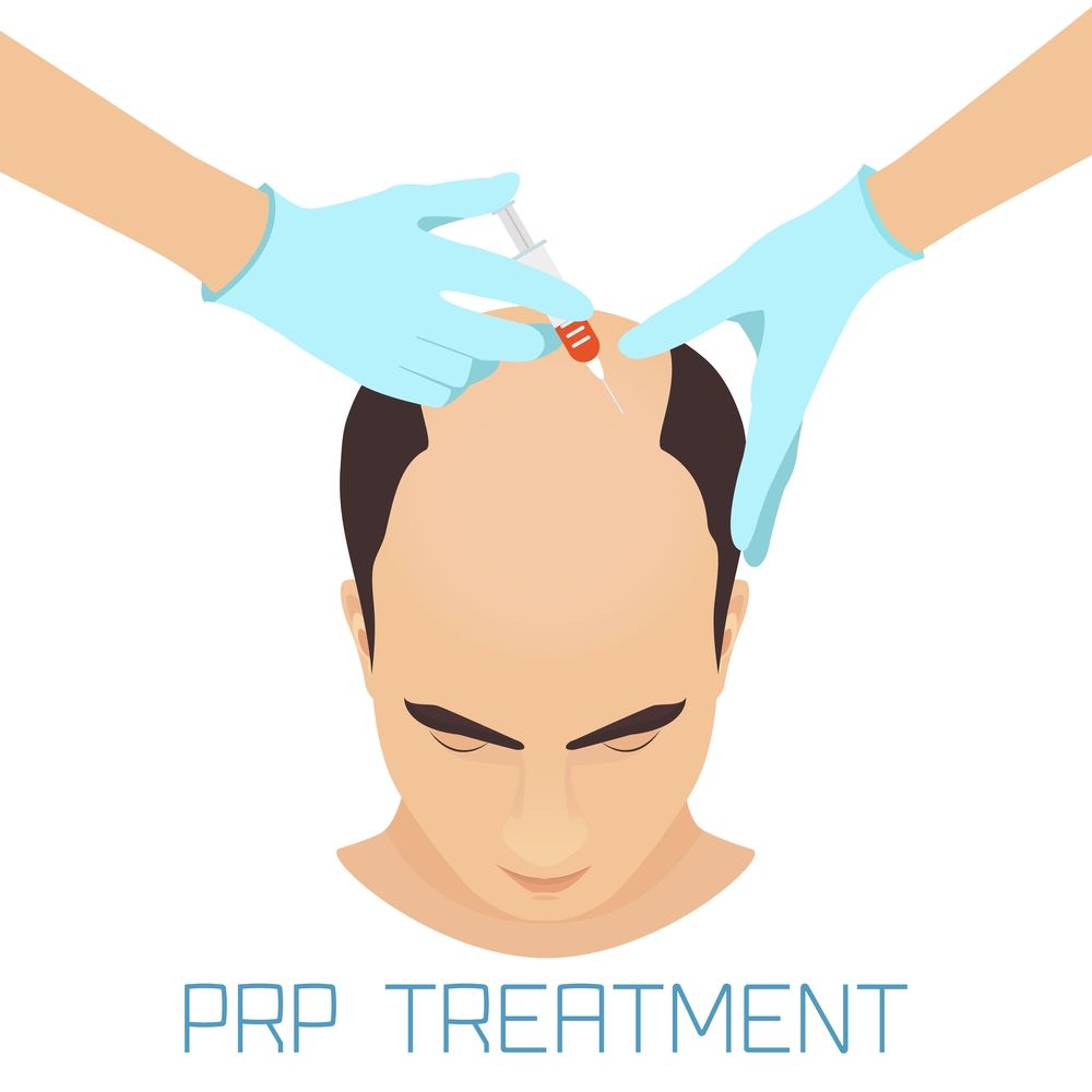 prp therapy