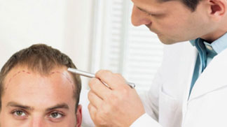 Hair Transplant in Patna