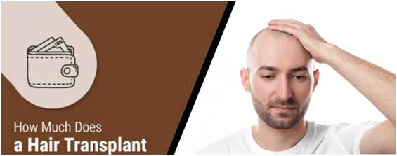 Hair Transplant Cost