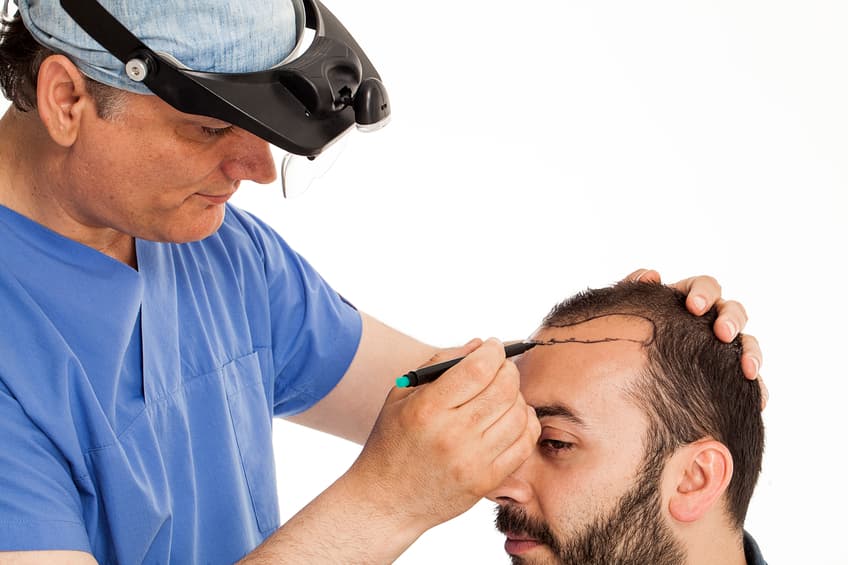 Hair Transplant in Amritsar  Best Doctors Clinics  Cost  FCHTC