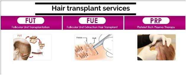 Hair Transplant Cost in Varanasi | Hair Transplant Varanasi | Hair  Transplant Clinic & Doctors Varanasi