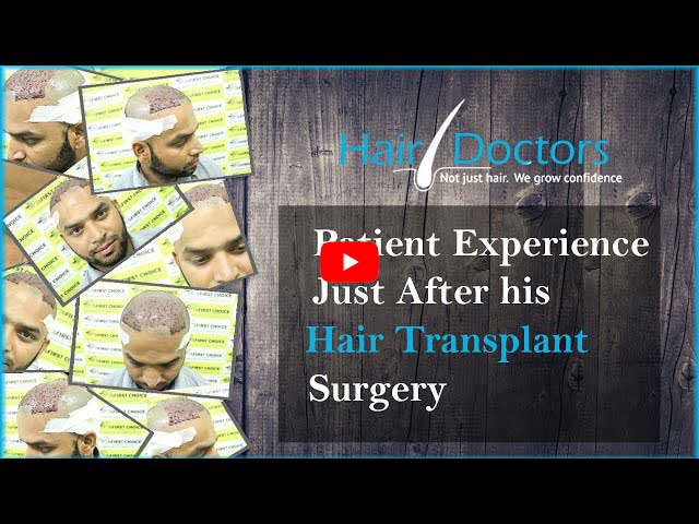 Hair Transplant in Dimapur - Hair Loss Treatment Cost & Clinics