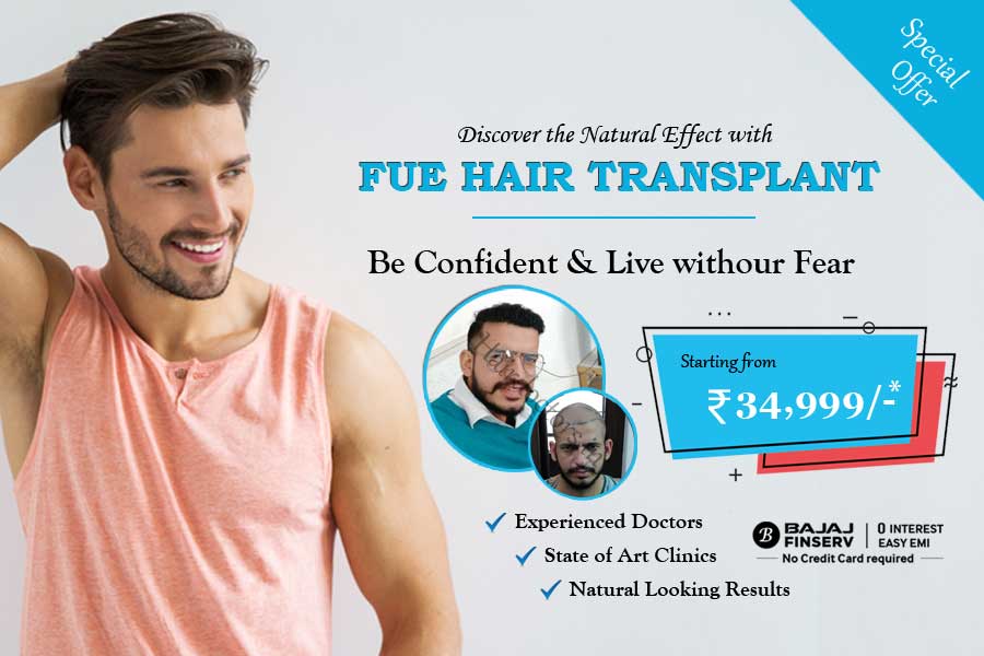 Hair Transplant in Noida - Hair Loss Treatment Cost & Clinics
