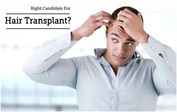 Hair Transplant Right Candidate