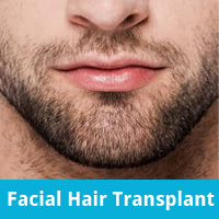 FUE Hair Transplant