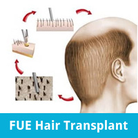 FUE Hair Transplant